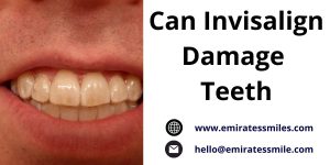 Can Invisalign Damage Teeth